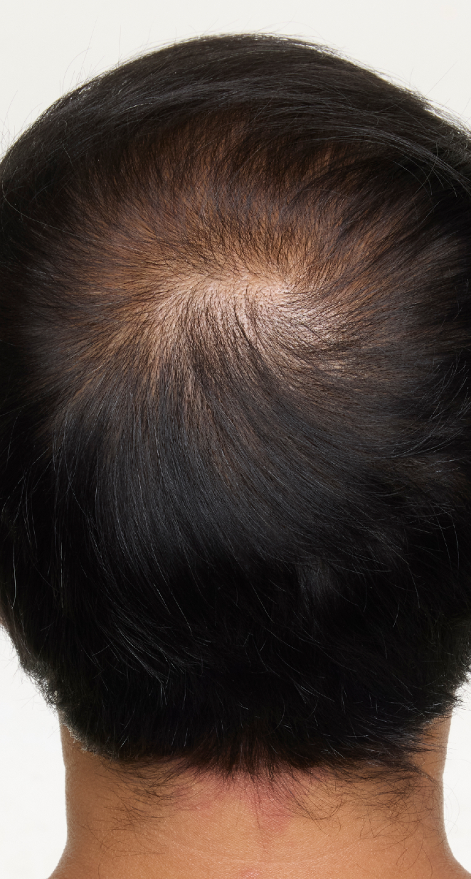 hair-men-result-2-after.png