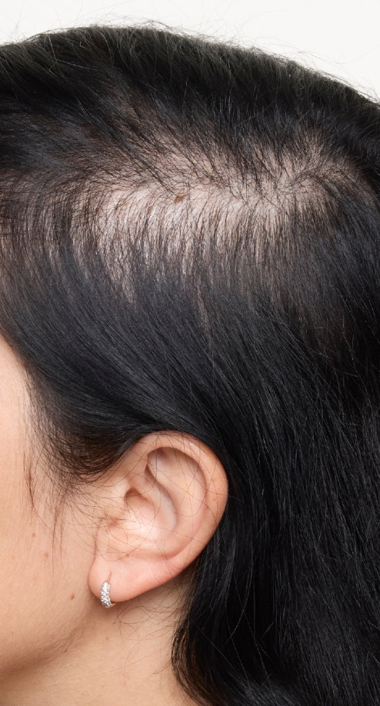 hair-women-result-1-before.jpg