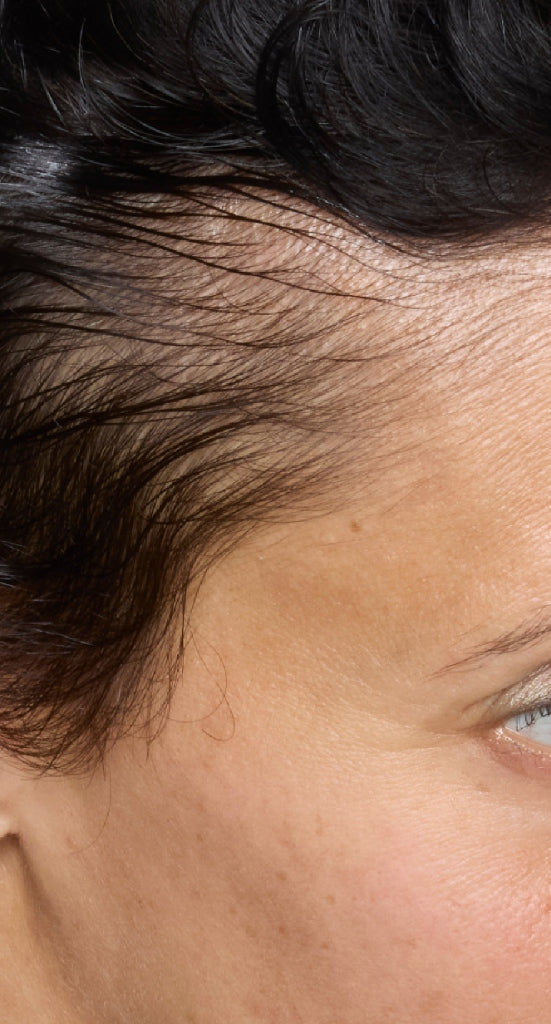 hair-women-result-2-before.jpg