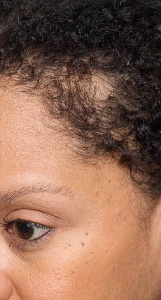 hair-women-result-4-before.jpg