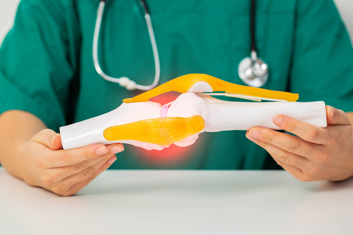 Doctor surgeon holds a medical model of the knee joint in his hands