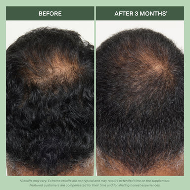 Dynamic Hair Energy for Men™