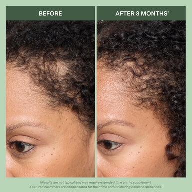 Dynamic Hair Energy for Women™