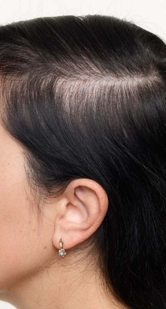 hair-women-result-1-after.jpg