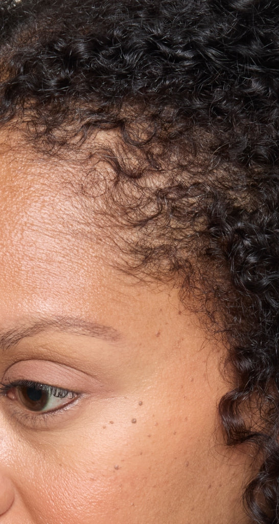 hair-women-result-4-after.jpg